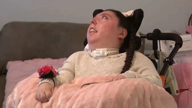 মস্তিষ্ক ছাড়াই ২০ বছর বেঁচে তরুণী, চিকিৎসকদের চোখে ‘জীবন্ত বিস্ময়’!