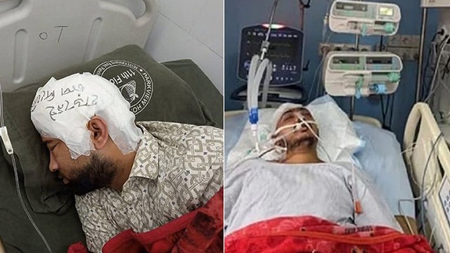 হাসপাতালে চিকিৎসাধীন মামুন ও ইমতিয়াজ আহমেদ সায়েম