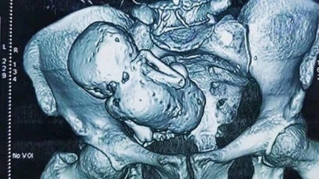 ছবি : সংগৃহীত